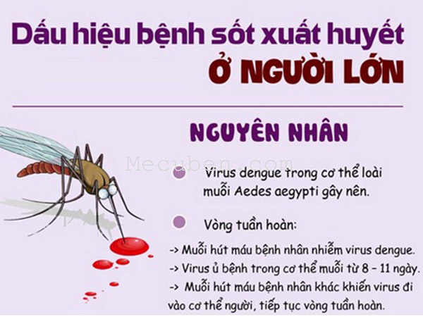Dấu hiệu nhận biết bệnh sốt xuất huyết trong từng giai đoạn