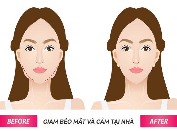 Béo mặt, nguyên nhân do đâu?