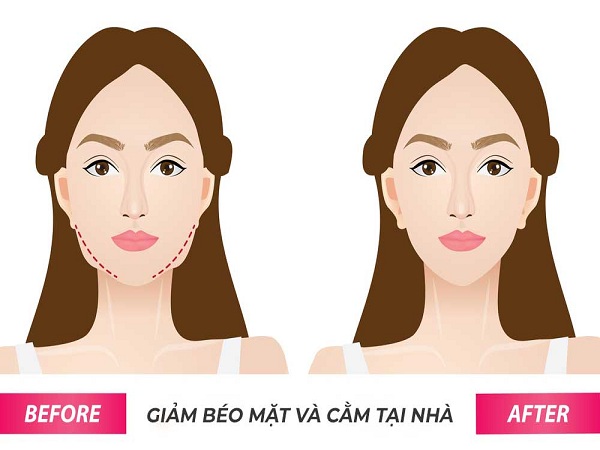 Béo mặt, nguyên nhân do đâu?