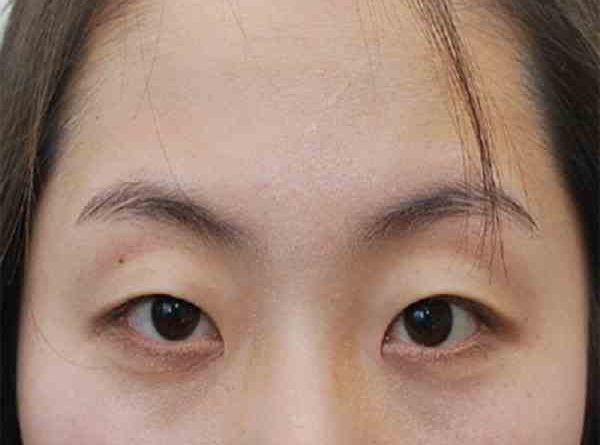 tướng mắt hạc