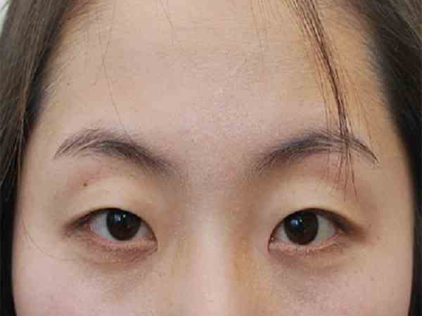 Đặc điểm nhận diện đôi mắt hạc