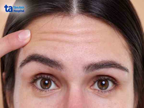 Nếp nhăn ngang và sự nghiệp