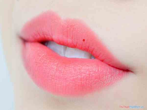 Nốt ruồi son ở giữa môi trên Nốt ruồi son ở giữa môi trên