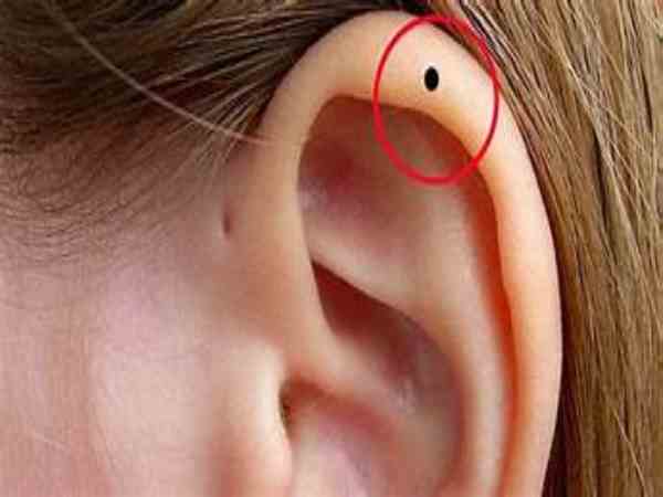 Nốt ruồi ở vành tai bên trái của nữ Nốt ruồi ở vành tai bên trái của nữ