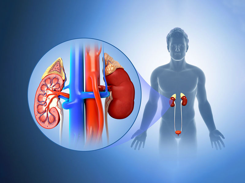 Các loại sỏi thận phổ biến