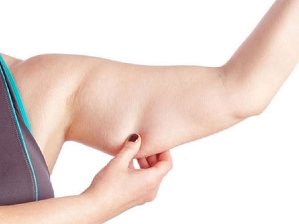 Nguyên nhân gây tích tụ mỡ ở bắp tay