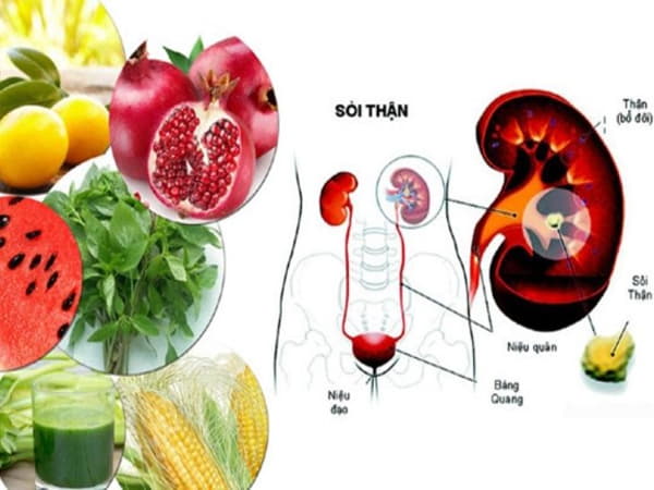Thực phẩm nên dùng khi bị sỏi thận