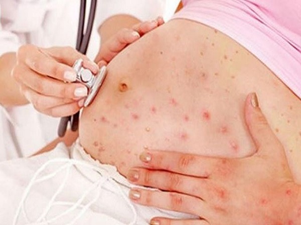 Khi nào mang thai bị ngứa khắp người nên đến gặp bác sĩ?