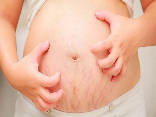 Nguyên nhân phổ biến gây ngứa khi mang thai