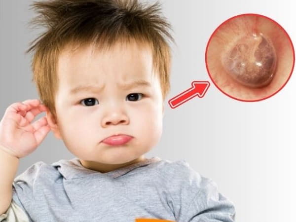 Nhận biết sớm dấu hiệu viêm tai giữa ở trẻ